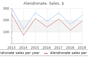 buy generic alendronate 35mg line